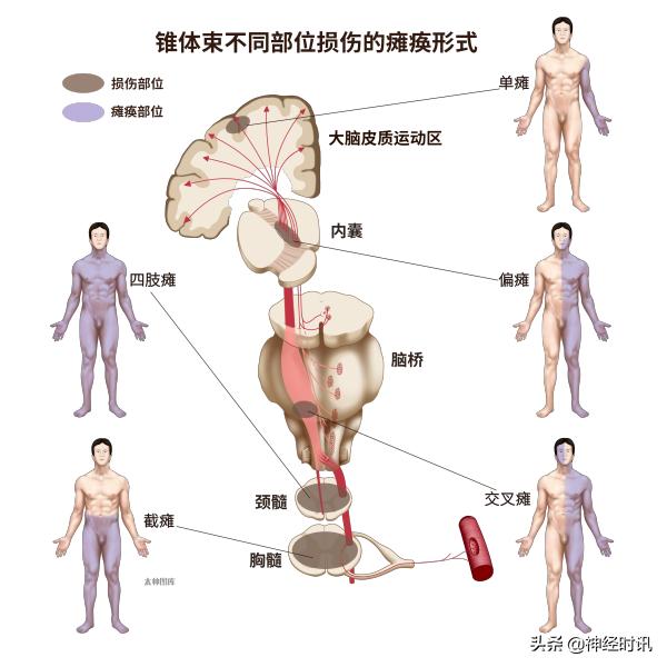 神经系统笔记,神经系统有关的笔记