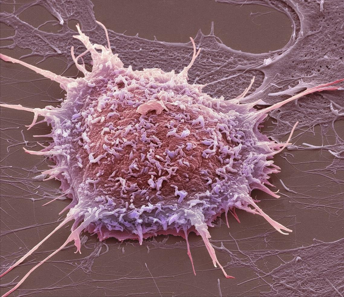 派特灵hpv科普讲堂,派特灵治疗宫颈高危hpv得多少钱