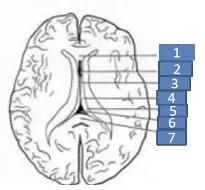 侧脑室就是透明隔腔吗,第五脑室是透明隔吗