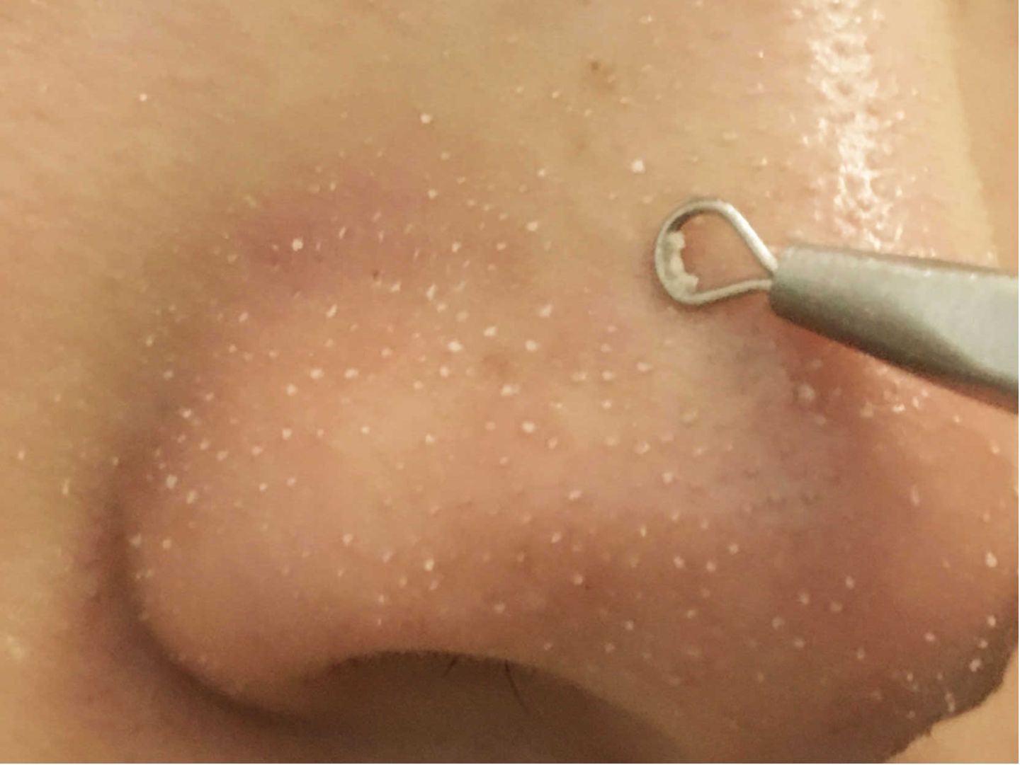 涂完粉底液鼻子上有白点,上完粉底液之后为什么鼻子有白点