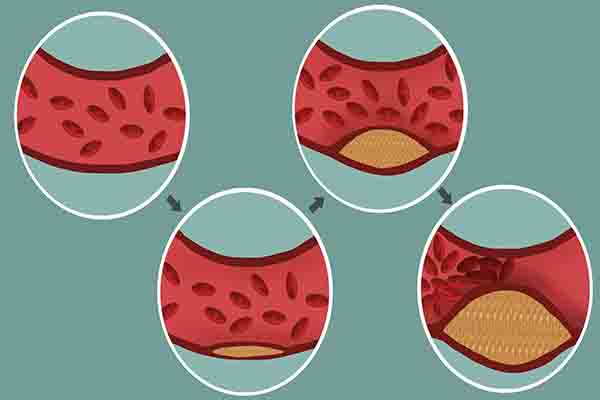 硒抵抗癌症吃五种食物不怕缺硒,缺硒地区老年人一天补充多少硒