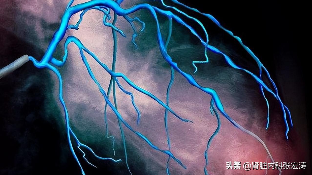 增强ct用造影剂对肾脏影响有多大,增强血管ct检查对人有伤害吗