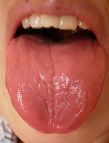 平肝潜阳养阴清热用什么药,入睡难疏肝的中成药有哪几种