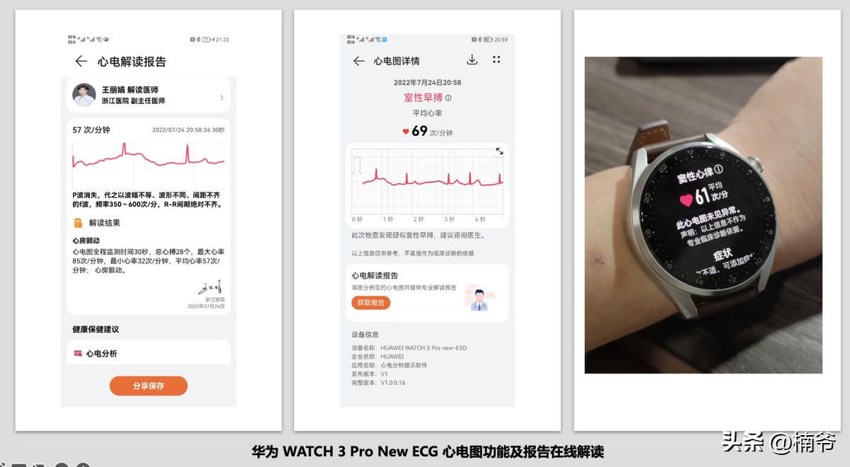 从健康管理开始,华为watch3pronew运动功能评测