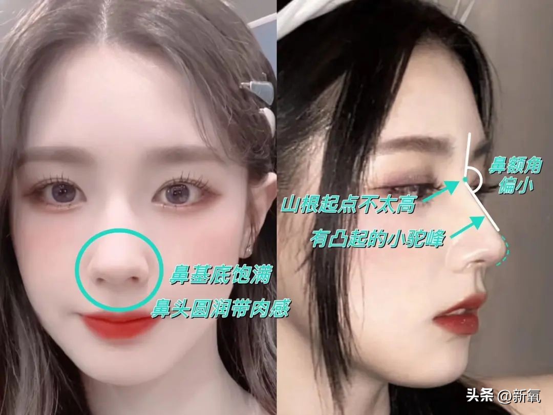 改一点赢很大？她整完鼻子直接美成断代神颜…