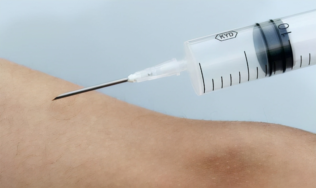 全身麻醉为什么人会失去意识,全身麻醉等于死过一次吗