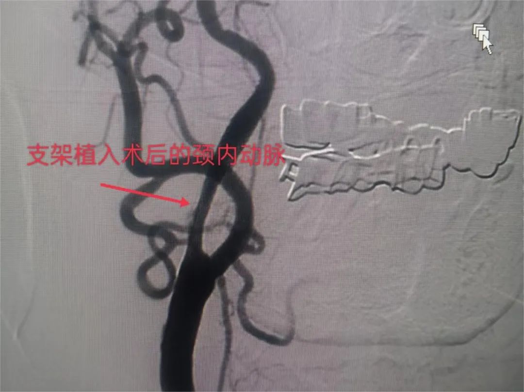 济南市莱芜人民医院口镇分院,山东打通生命通道济南