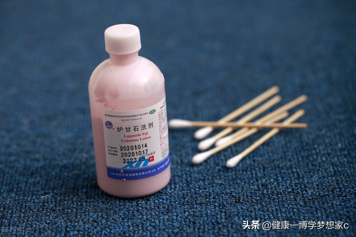 女人肛门痒怎么治疗,女肛门痒痒怎么治疗