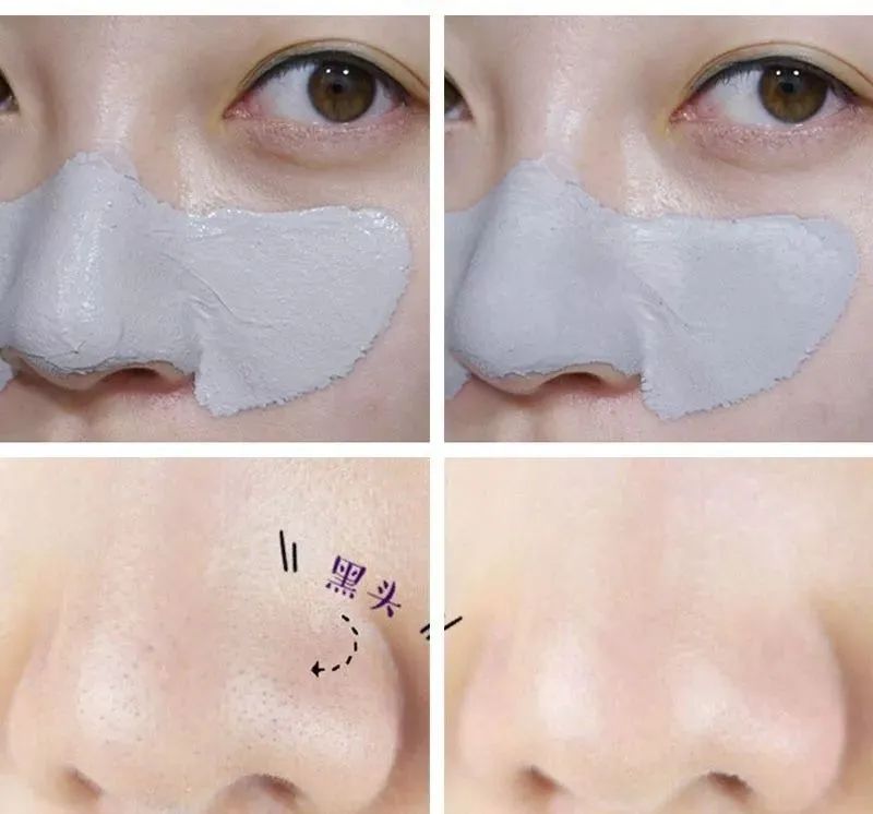 韩国悦诗风吟抗皱,韩国悦诗风吟哪个套装好用