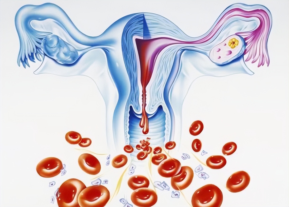 大姨妈结束以后一直有褐色分泌物,为什么月经结束后有褐色分泌物