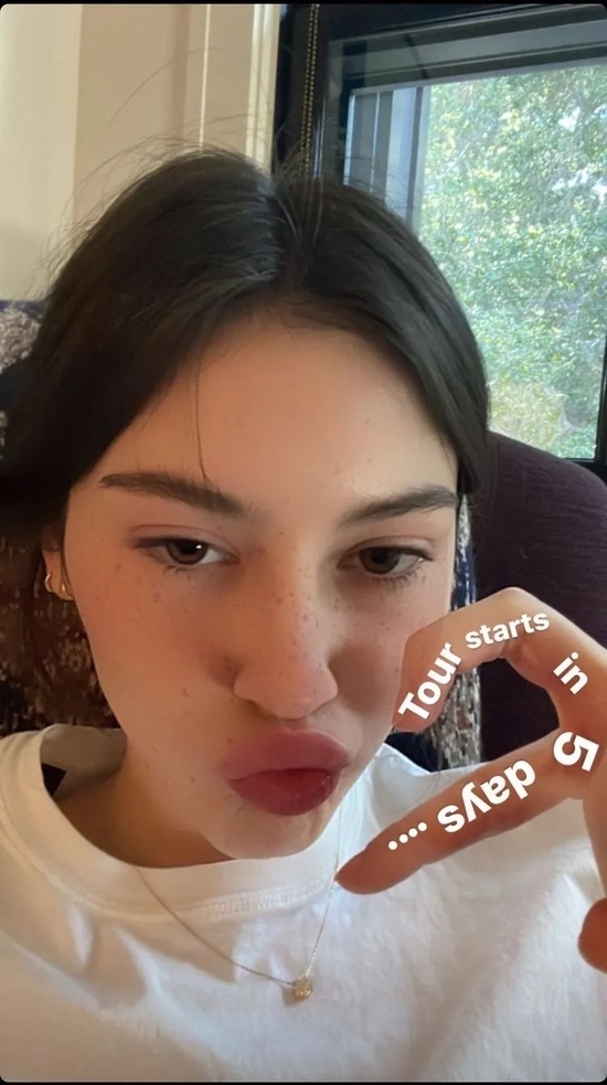 石原里美、Chloe都在用的祛痘、祛痘印方法 你不想知道吗？