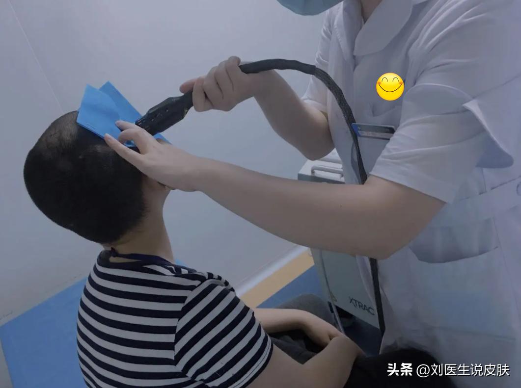 白癜风是什么引起的白癜风怎么治,得了白癜风怎么治白癜风效果好