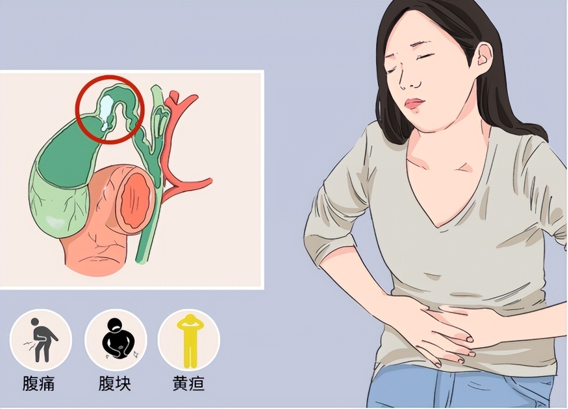 急性胆囊炎发作的原因有哪些,急性胆囊炎的症状及治疗都有哪些