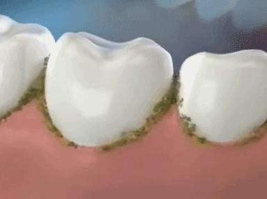 大人口腔细菌会传染宝宝吗,大人口腔多少细菌传染宝宝