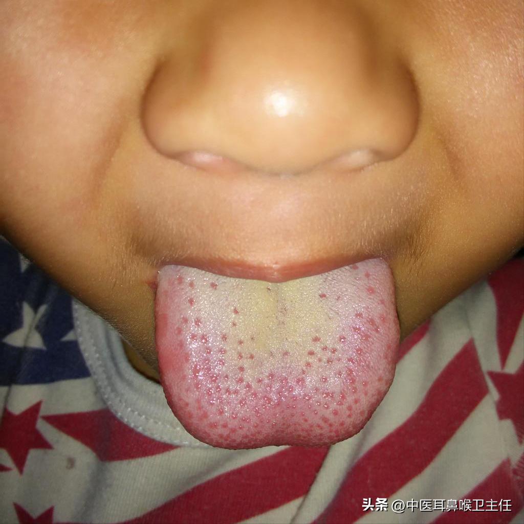 积食咳嗽后晚上不咳白天咳咋回事,积食咳嗽什么时间咳