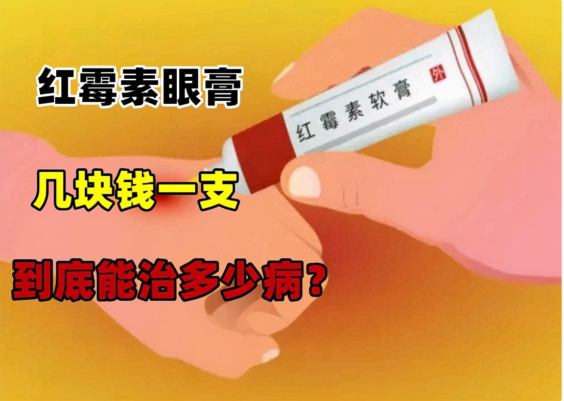 几块钱一支的红霉素眼膏,到底能治多少病?答案来了