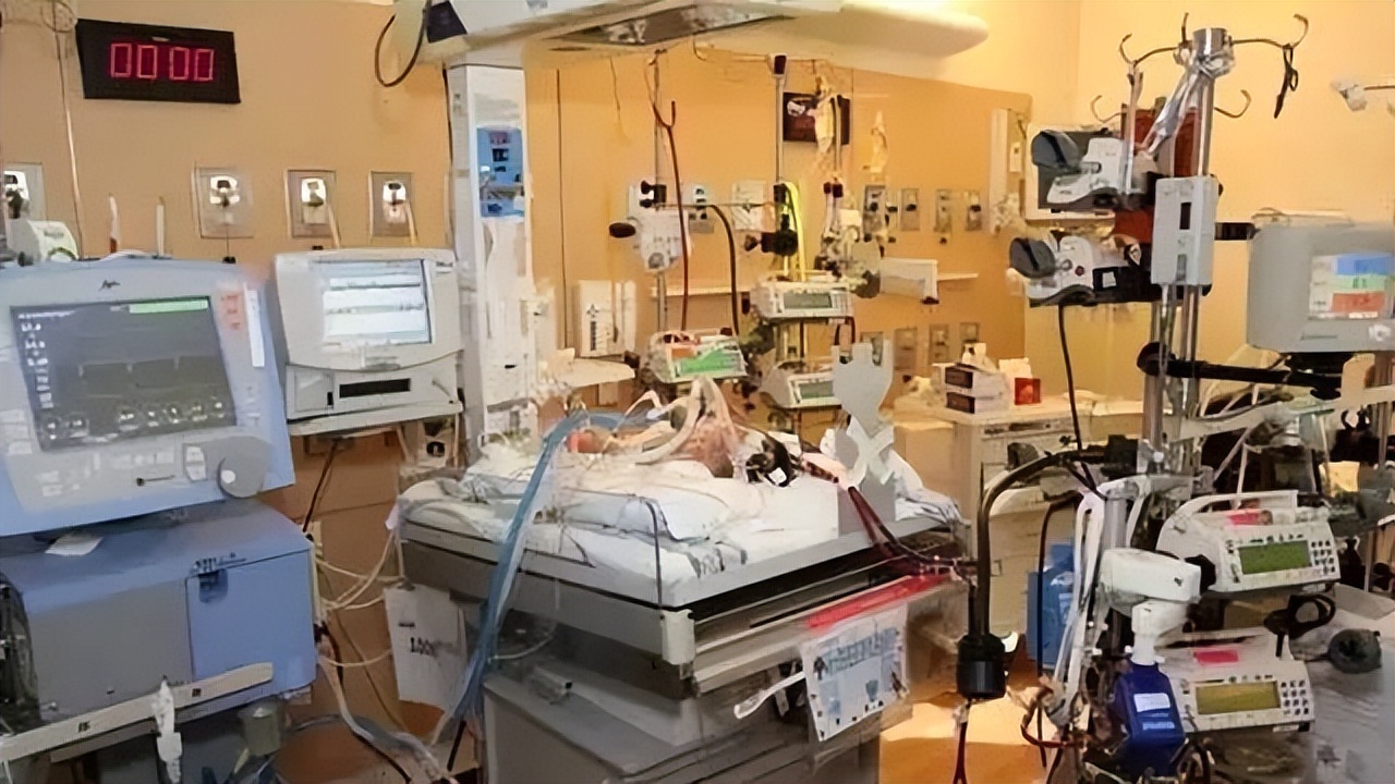 ecmo政策,ecmo国产化有用吗