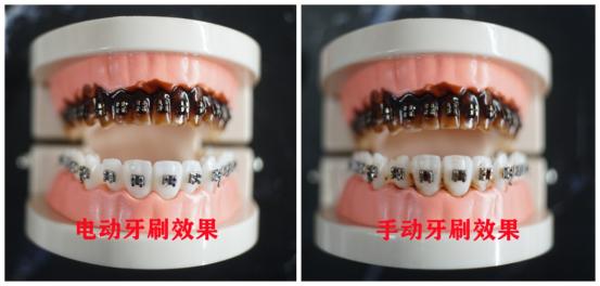 便宜电动牙刷有危害,使用超声波电动牙刷有什么危害吗