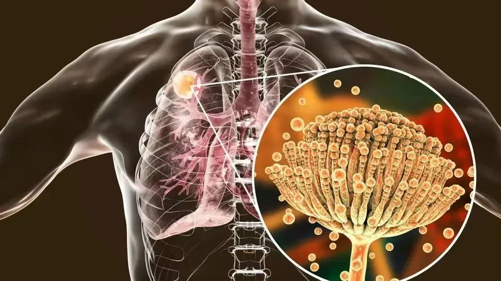 建筑物渗漏修缮,建筑除湿防潮措施