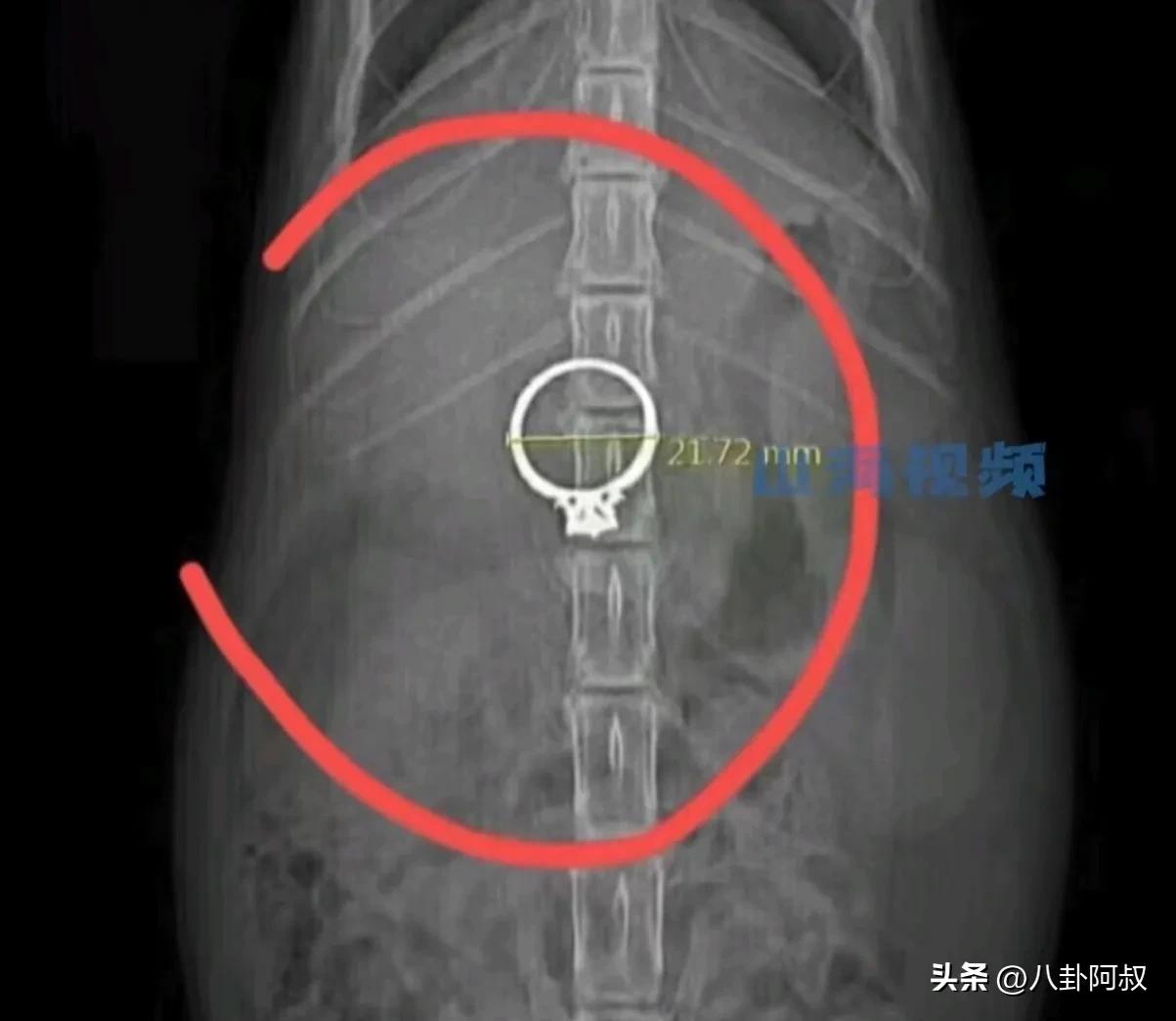 狗狗把钻戒吞了,广州钻戒掉地上让狗吃了