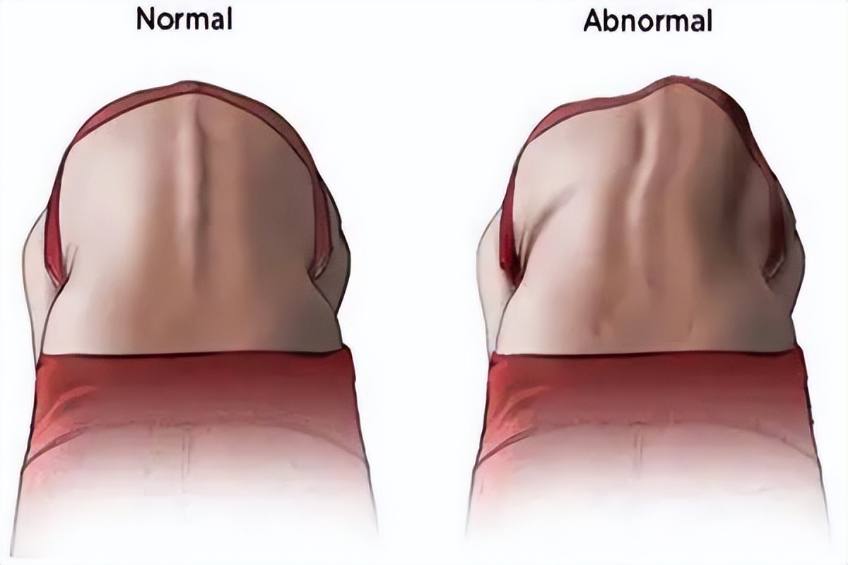 吃方便面有危害是谣言吗,吃方便面真能致癌吗