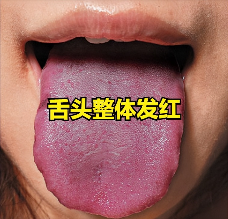 失眠舌头发涩是什么征兆,经常失眠舌苔白