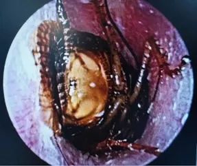 小东西解决大烦恼,小东西太多怎么解决