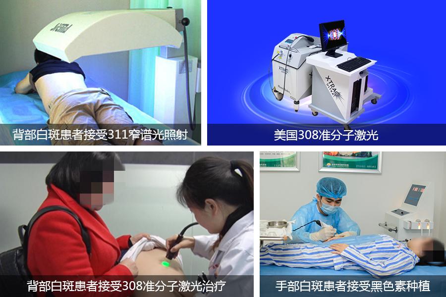 @冯导，白癜风治疗有新药了，显著改善面部全身白癜风