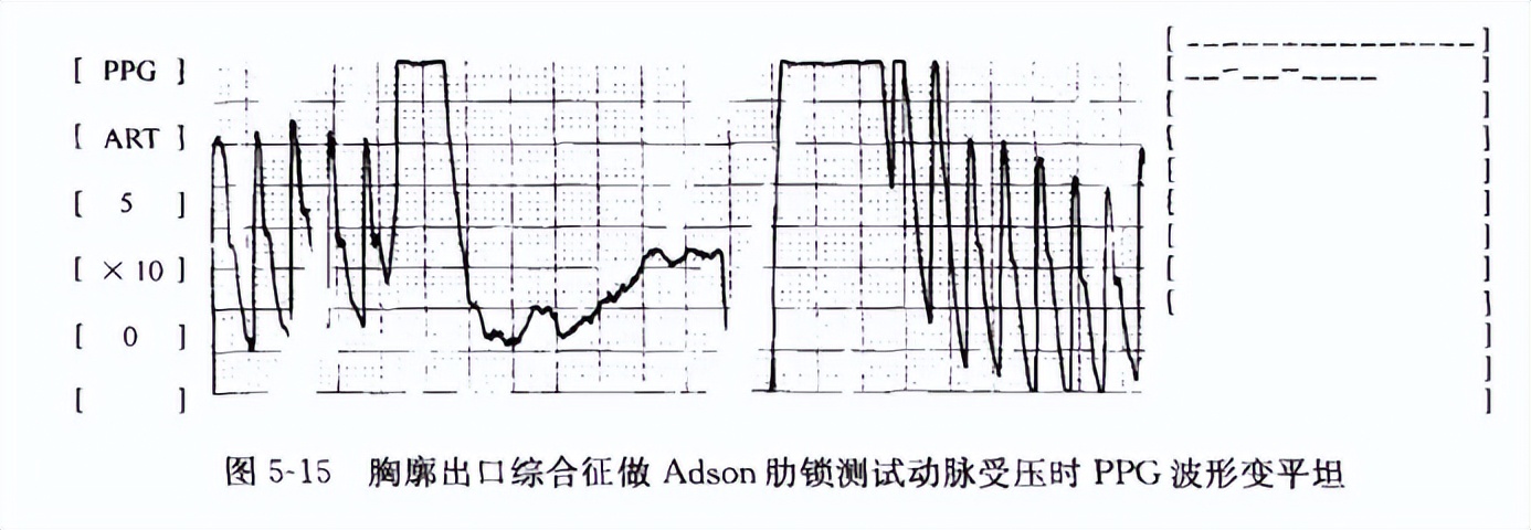 有关血管外科学的书推荐,血管外科临床解剖学第2版