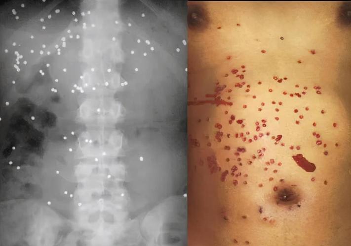 村民夜钓疑被当成野猪,江西夜钓被当野猪打