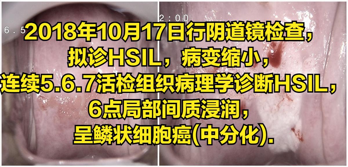 认真管理重要性,宫颈门诊的管理流程