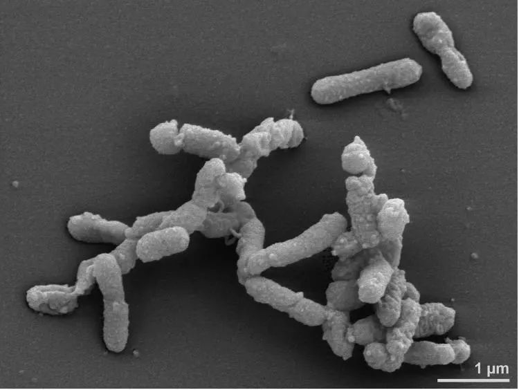 肠道菌群中占大多数的是拟杆菌 (肠道杆菌中对酸敏感的细菌)