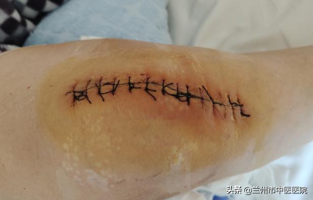 兰州市中医骨伤科医院,兰州中医骨伤科医院康复科