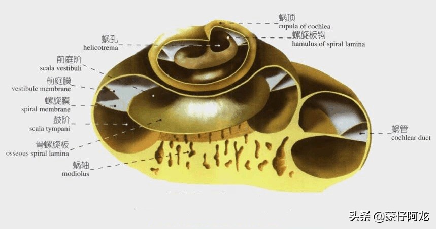 人工耳蜗是什么东西,什么是人工耳蜗为什么那么贵