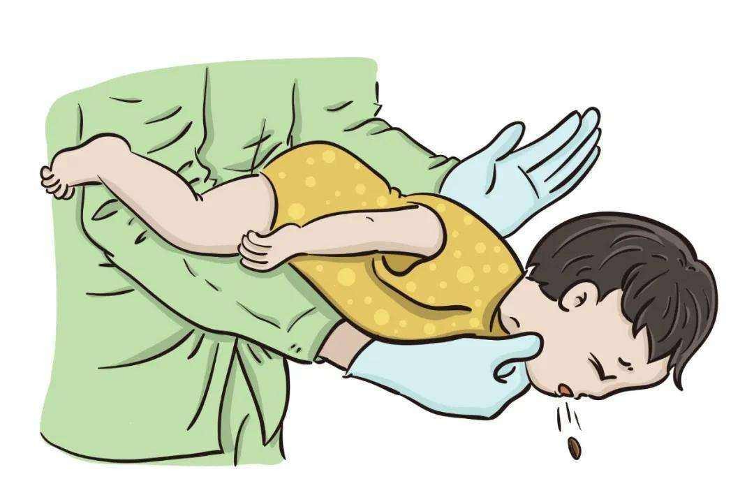 孩子卡住喉咙急救方法,异物卡住喉咙的自救方法