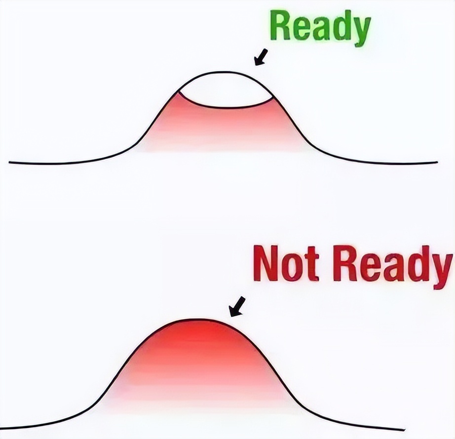 为什么说挤痘痘很危险,为什么说挤痘痘是往里面挤