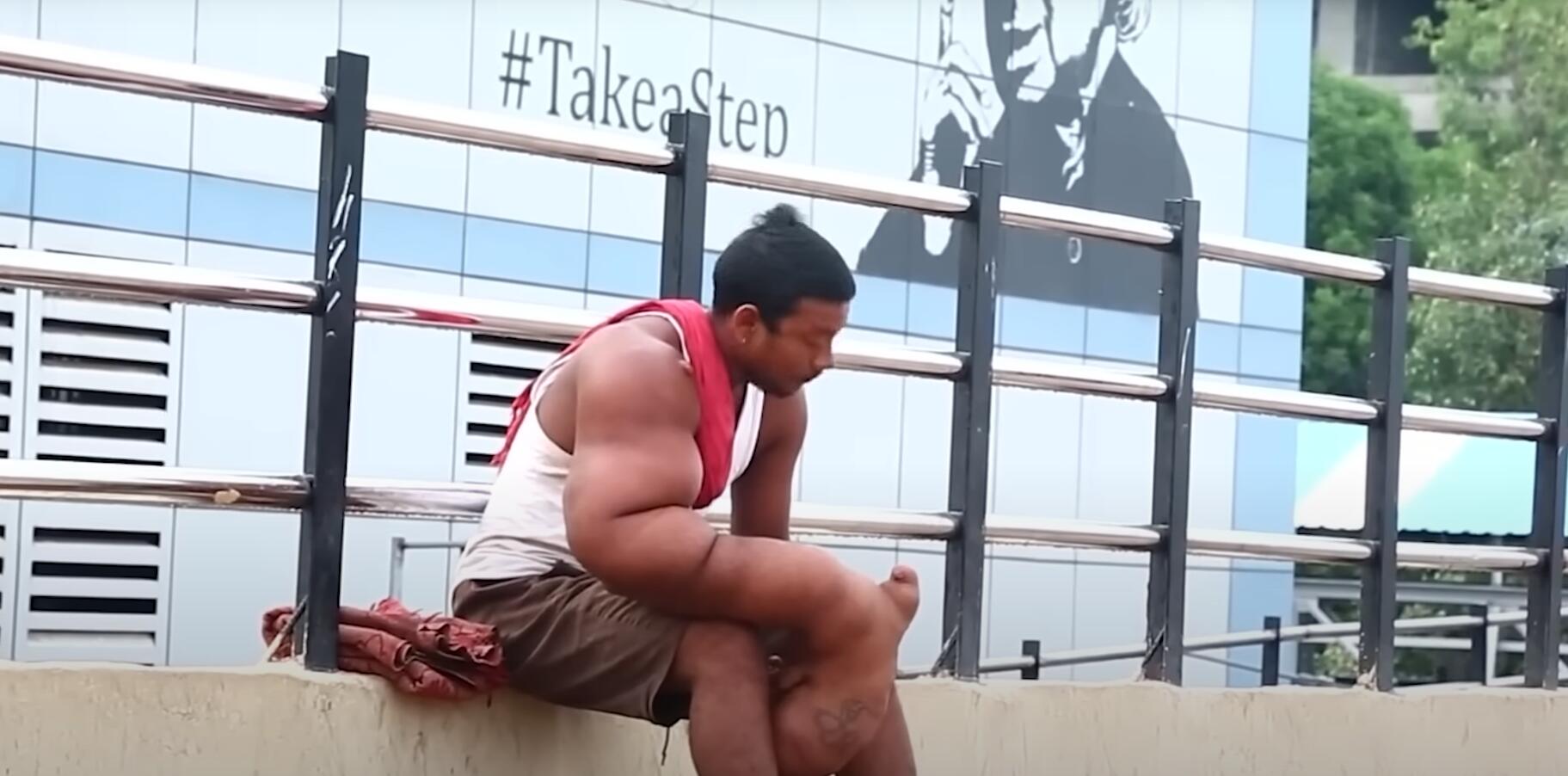 10个难以置信的人类，树皮人、外星人、拥有粗壮手臂的大力水手