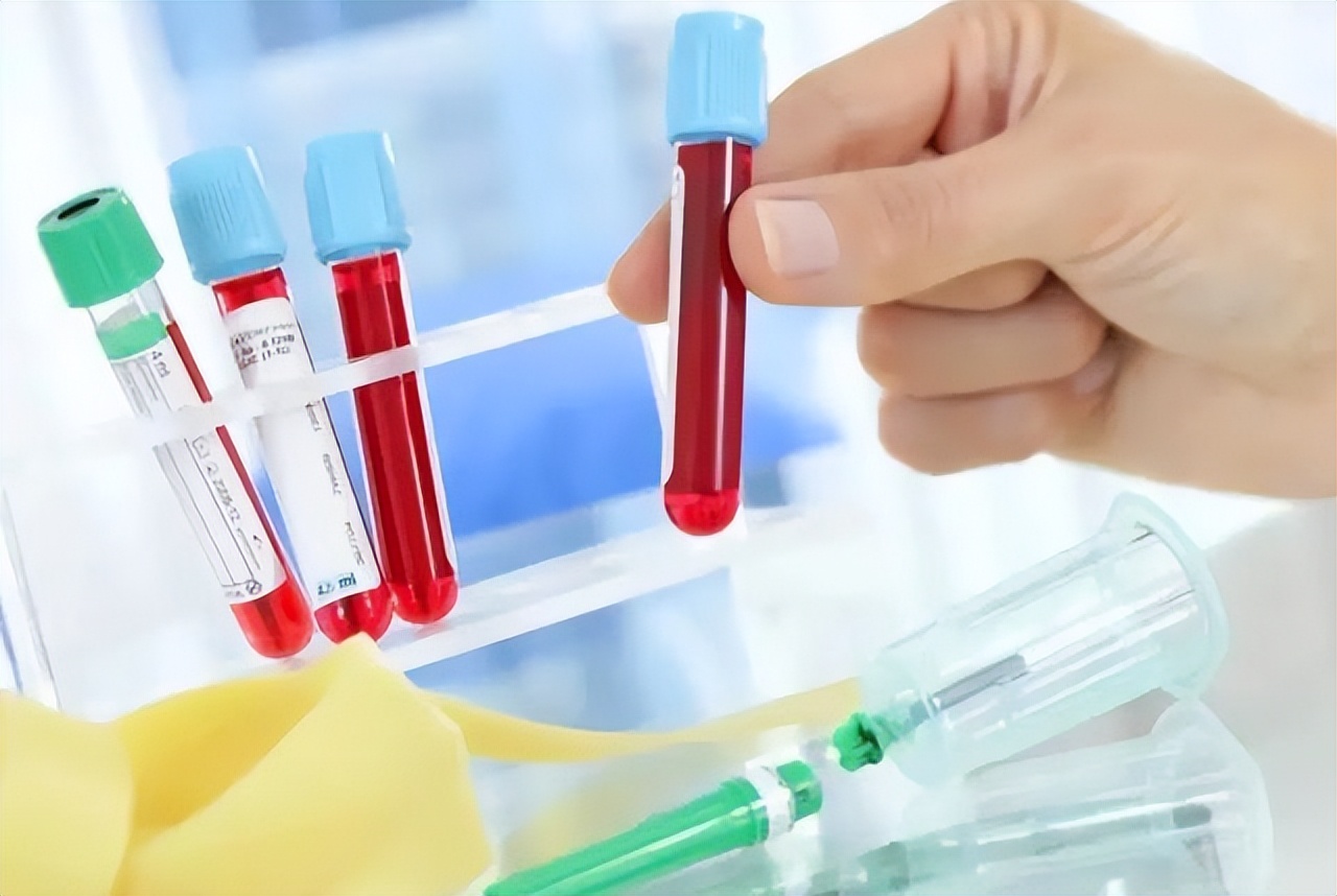 血常规中哪些指标升高需要再查,血常规各项指标偏高如何快速降低