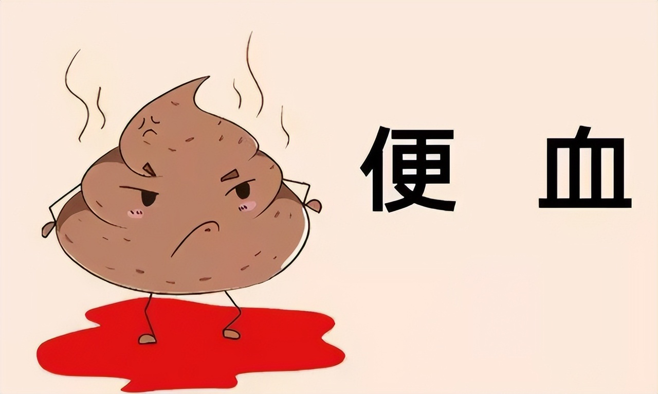 肠道长息肉有哪些明显的症状,肠道长息肉了会有什么症状