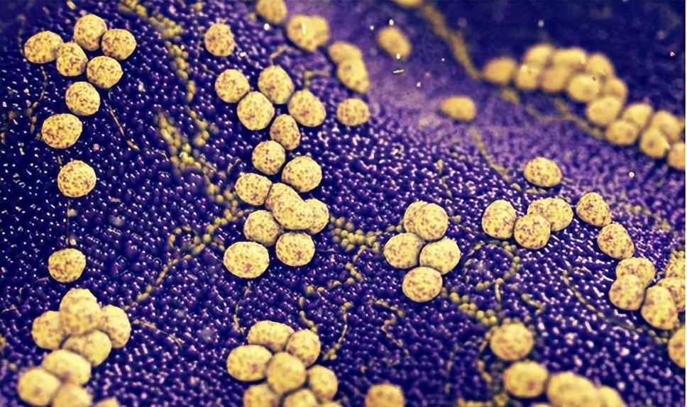 肛裂发病机理,肛裂最主要的临床表现是