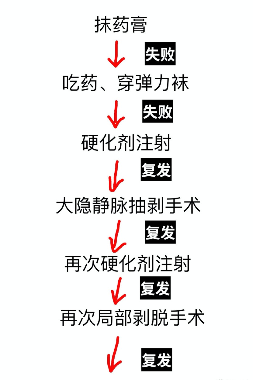 静脉曲张可以根治吗,静脉曲张能治好吗