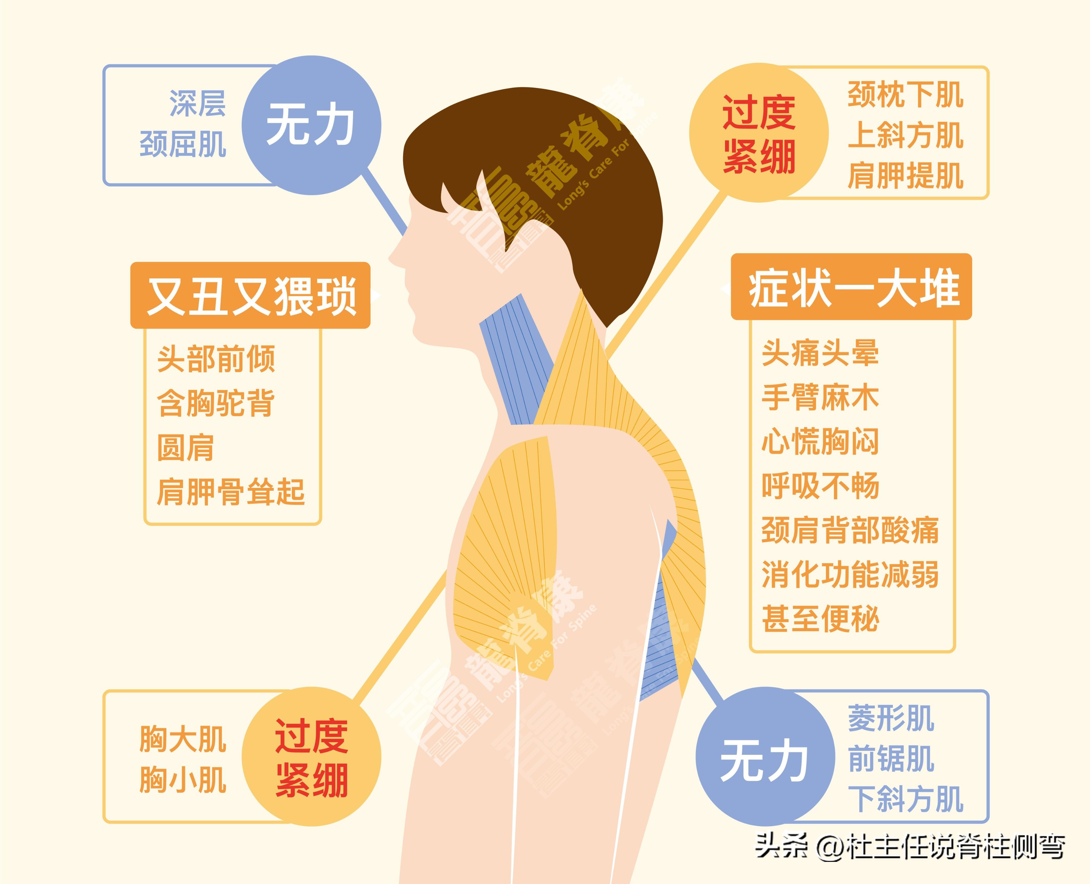 孩子含胸驼背怎么矫正,孩子含胸驼背矫正方法每天10分钟