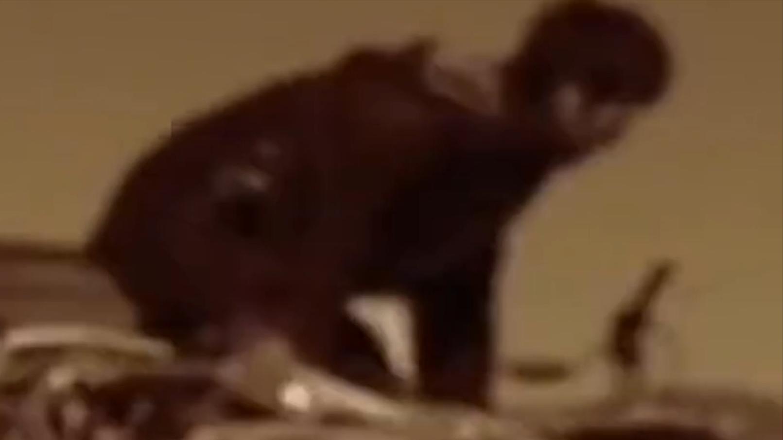 云南男子口臭手术后现在怎么样了,云南男子口臭查出了大毛病