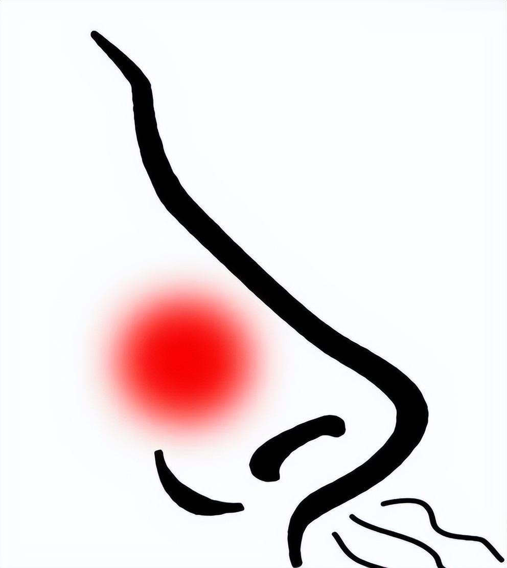 鼻头黑头发红毛孔粗大,怎么判断鼻子上是黑头还是毛孔大