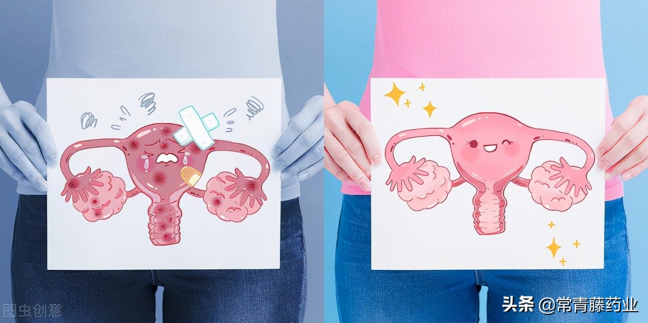 什么是腹腔镜子宫切除术,腹腔镜切除子宫疼痛厉害吗