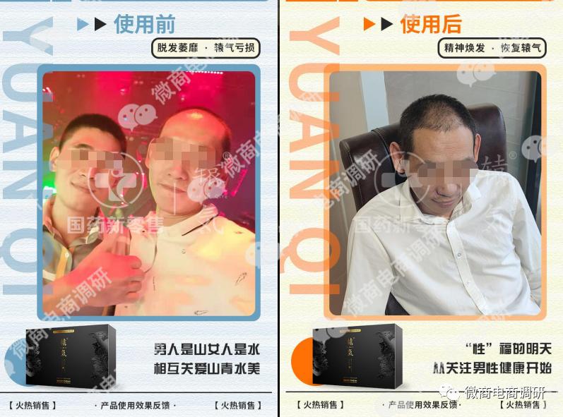 鍥借嵂闆嗗洟鑽夋湰鑳介噺楗枡,鍥借嵂闆嗗洟瑙ｉ厭楗枡浠ｇ悊