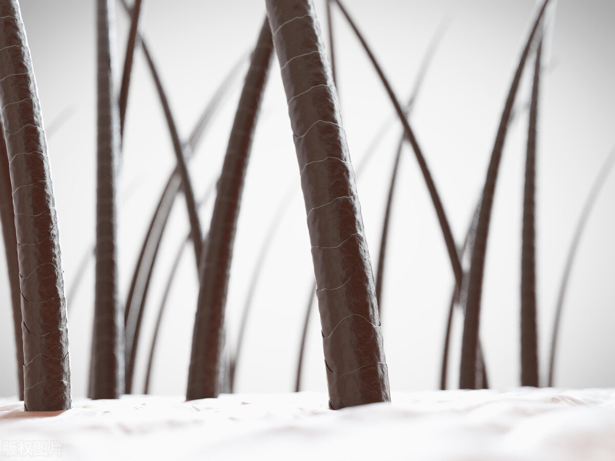 为什么头发是直的胡子却是卷的,头发眉毛都是白的是什么原因