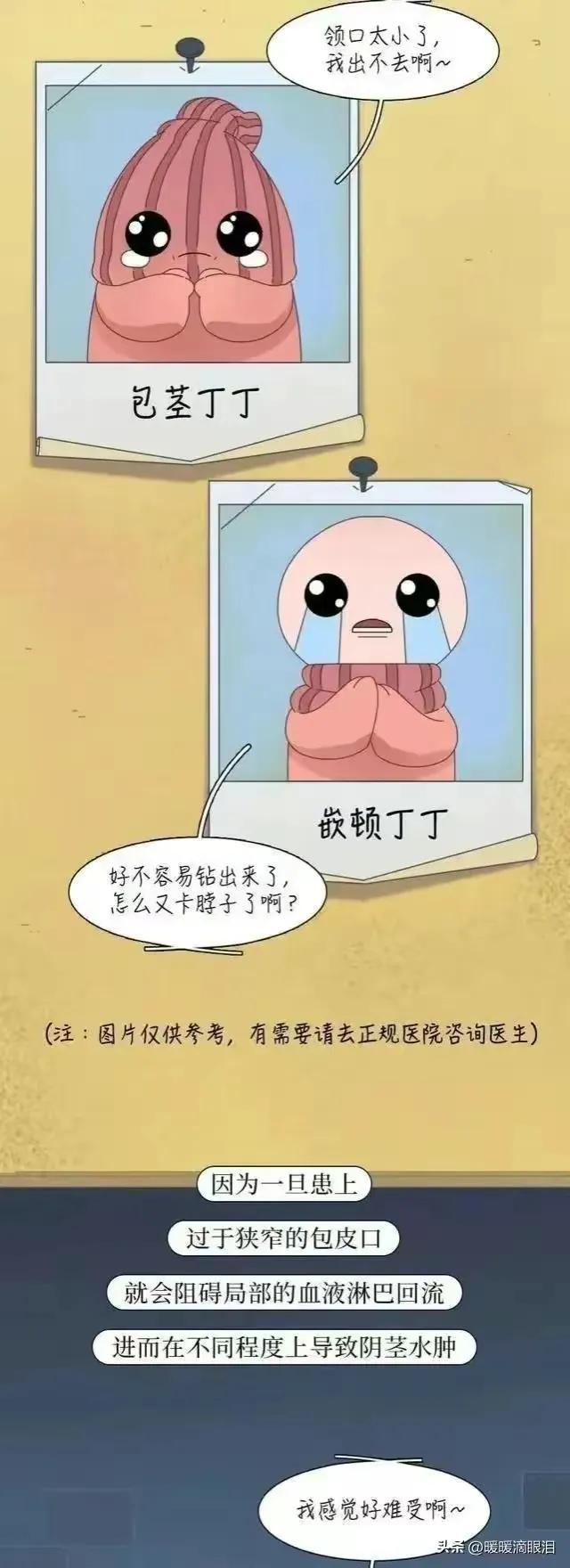 割完包皮会有什么变化,男生割过包皮之后有什么变化