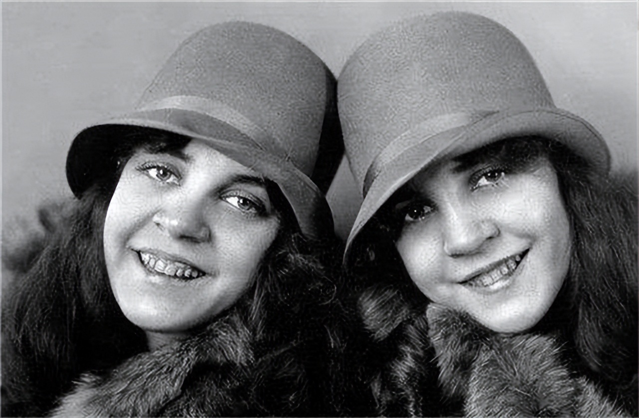 英国连体双胞胎姐妹,英国连体姐妹