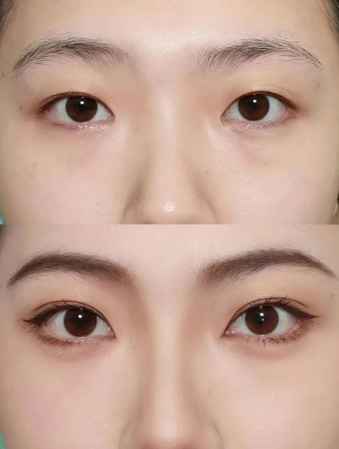 塌鼻子正脸好看,塌鼻子该如何变美啊